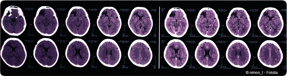 Neurosciences