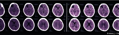 Neurosciences